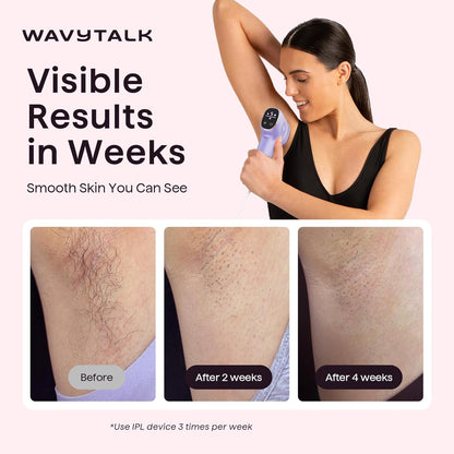 Wavytalk Dispositivo de depilación IPL, Bare It para bikini de cara...