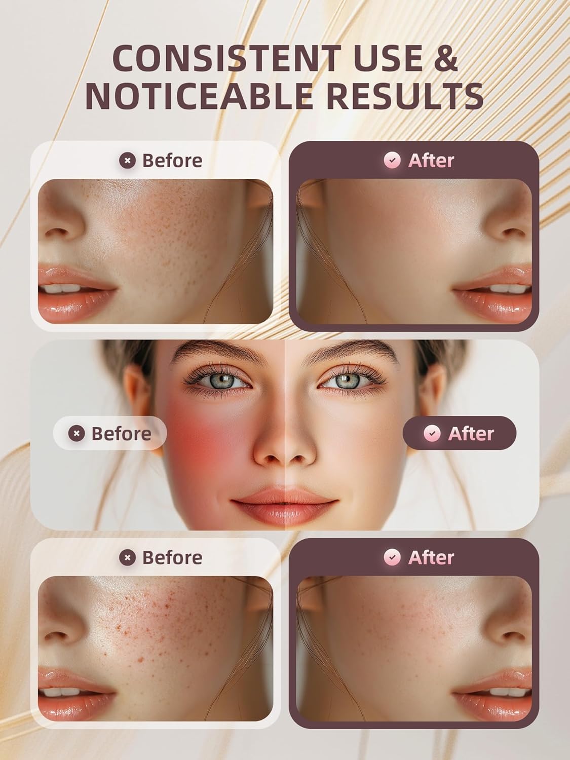 INTEO Masajeador facial multifuncional, dispositivo de brillo de vi...