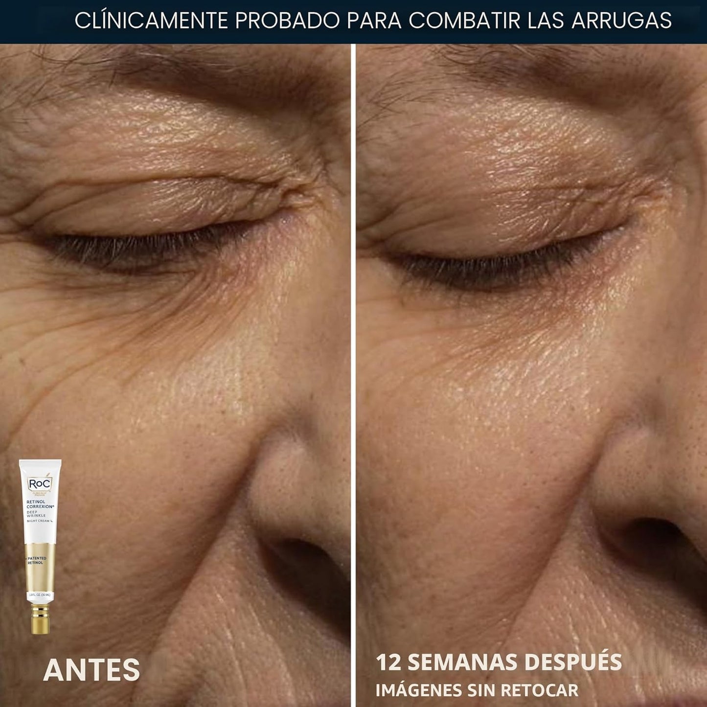 RoC conjunto de reparación de arrugas profundas, corrección con ret...