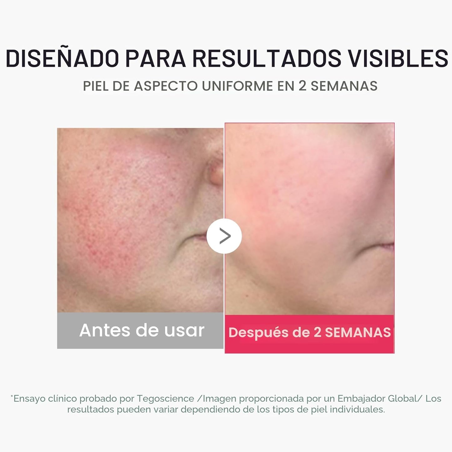 medicube Mini Booster Pro Plus | Dispositivo facial para piel radia...