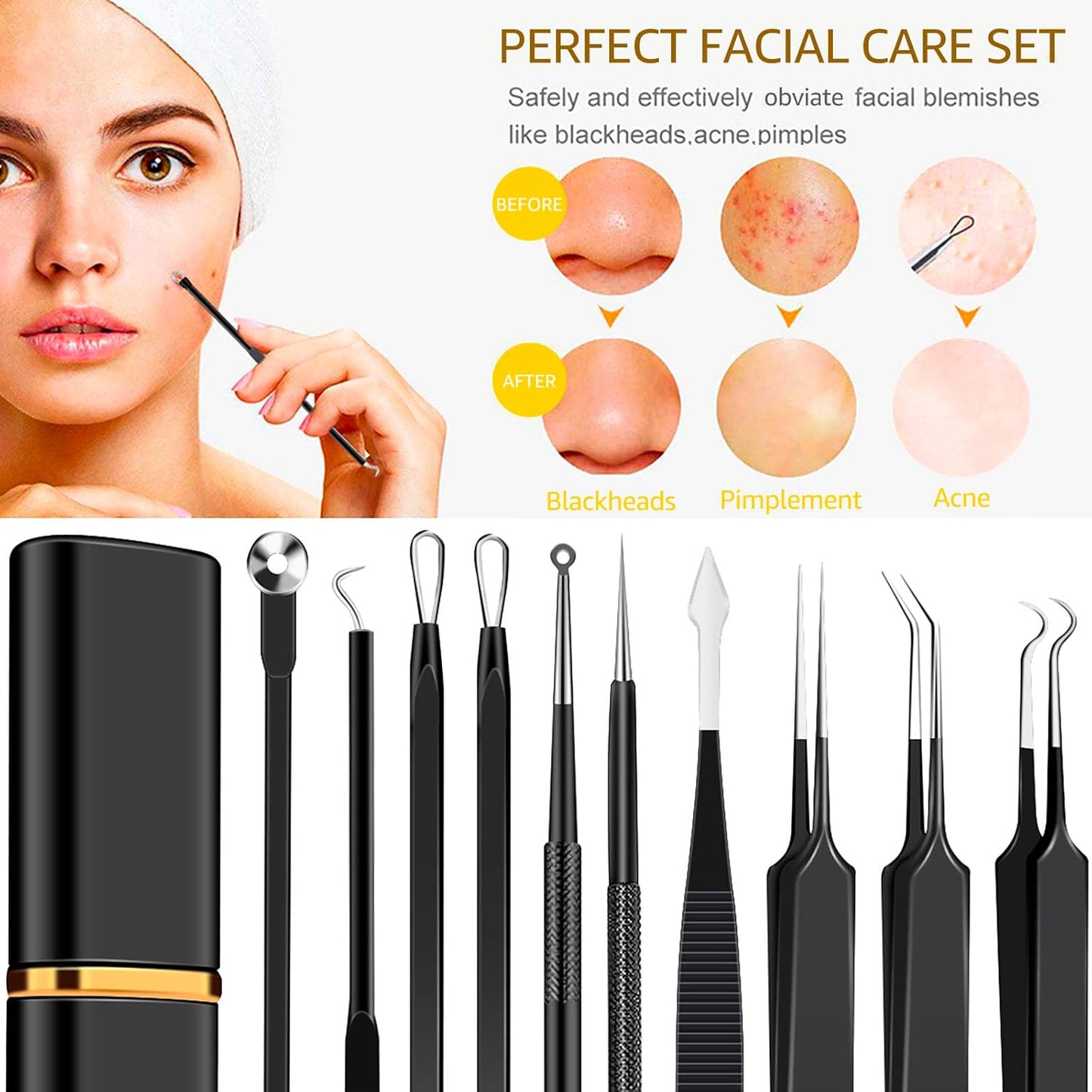 Kit de herramientas de 40 piezas de acero inoxidable para eliminar...
