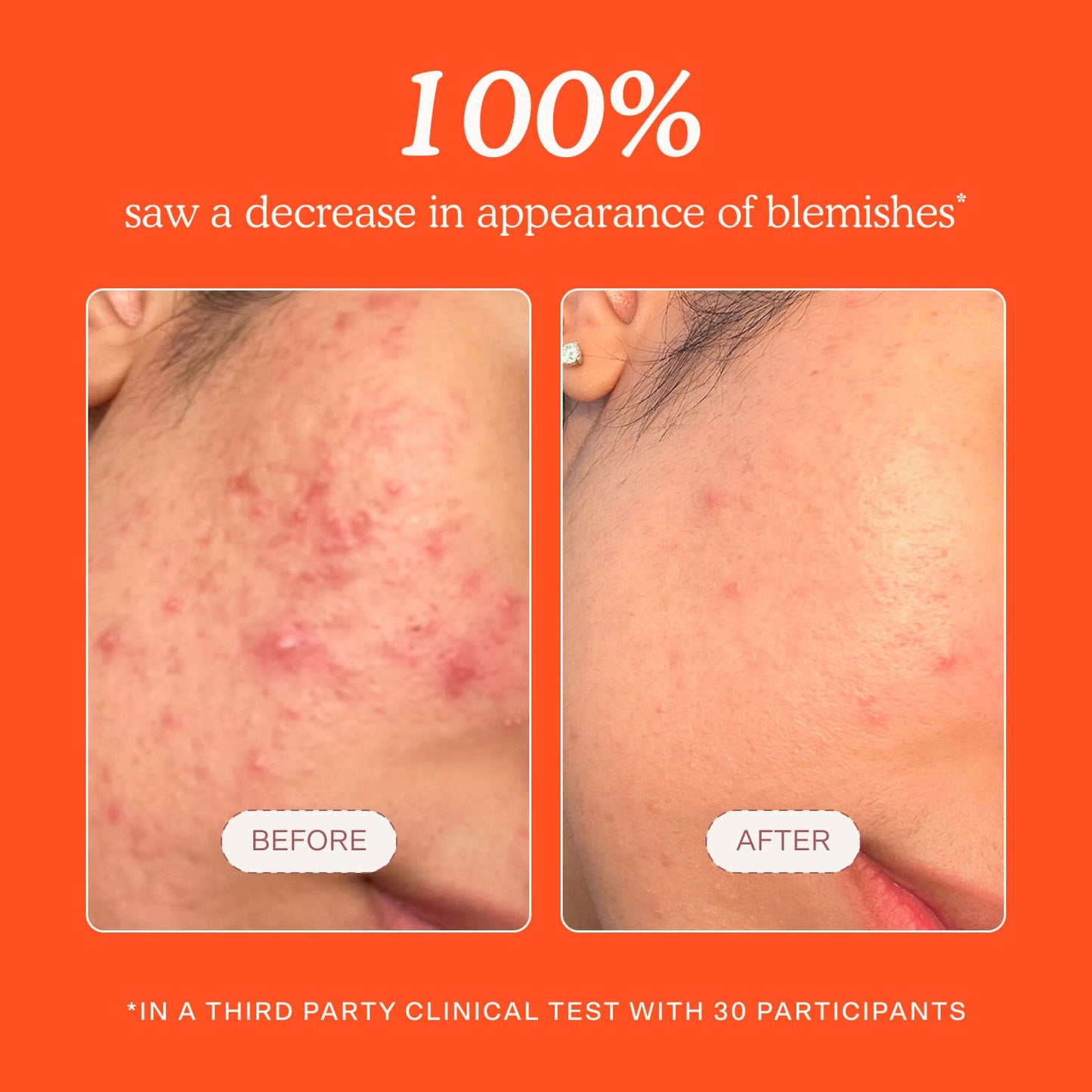 Tower 28 SOS Daily Rescue Spray facial \u2013 Spray de ácido hipocl...