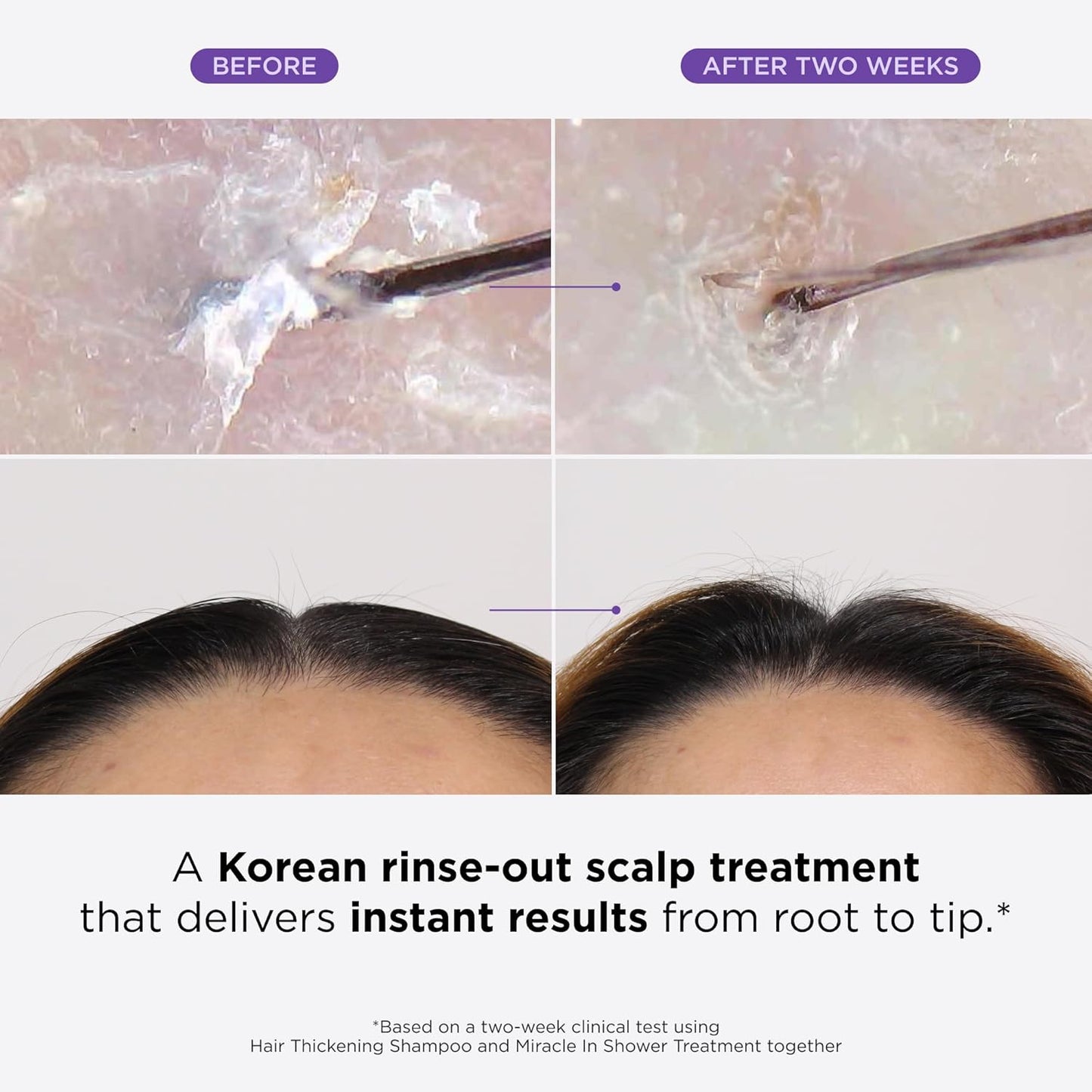 Dr. Groot Miracle in Shower - Tratamiento hidratante para la pérdida del cabello, enjuague coreano para el cuidado del cabello, aceite de romero para un cabello suave y saludable en 5 segundos, solución revitalizante del cuero cabelludo