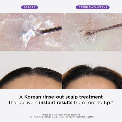 Dr. Groot Miracle in Shower - Tratamiento hidratante para la pérdida del cabello, enjuague coreano para el cuidado del cabello, aceite de romero para un cabello suave y saludable en 5 segundos, solución revitalizante del cuero cabelludo