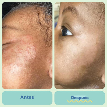 TUBBY TODD Baby Bundle - Conjunto de Cuidado de la Piel para Recién...