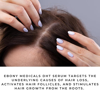 Ebony Medical Hair Support Serum - Fórmula Procapil que bloquea DHT - Fortalece el adelgazamiento del cabello y la salud del cuero cabelludo - Suero liposomal para el cuero cabelludo para un cabello más completo y grueso - 2 onzas líquidas