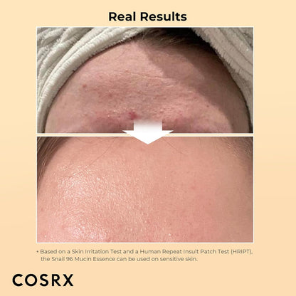COSRX Snail Mucin Duo - Snail 92 Cream & Snail 96 Essence, Gel Hidratante Facial Diario y Suero Hidratante para el Rostro con Filtrado de Secreción de Caracol, Cuidado de la Piel Coreano