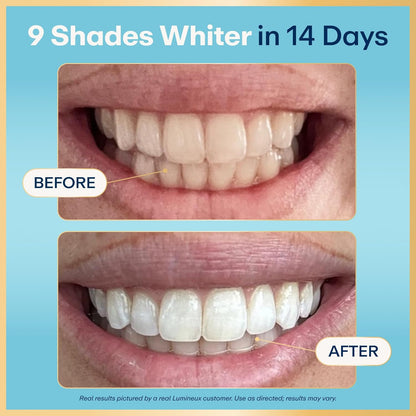 Lumineux Tiras blanqueadoras dentales, 35 tratamientos, sin peróxid...