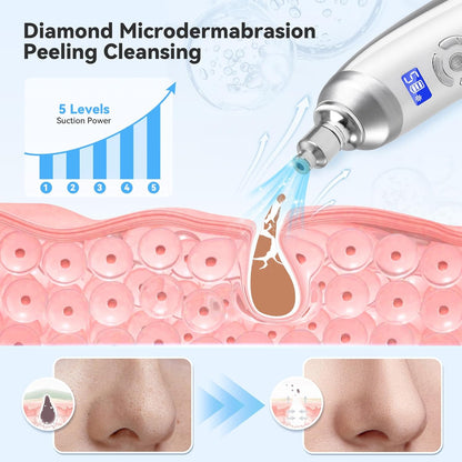 Máquina facial mejorada de micro dermoabrasión de diamante, herrami...