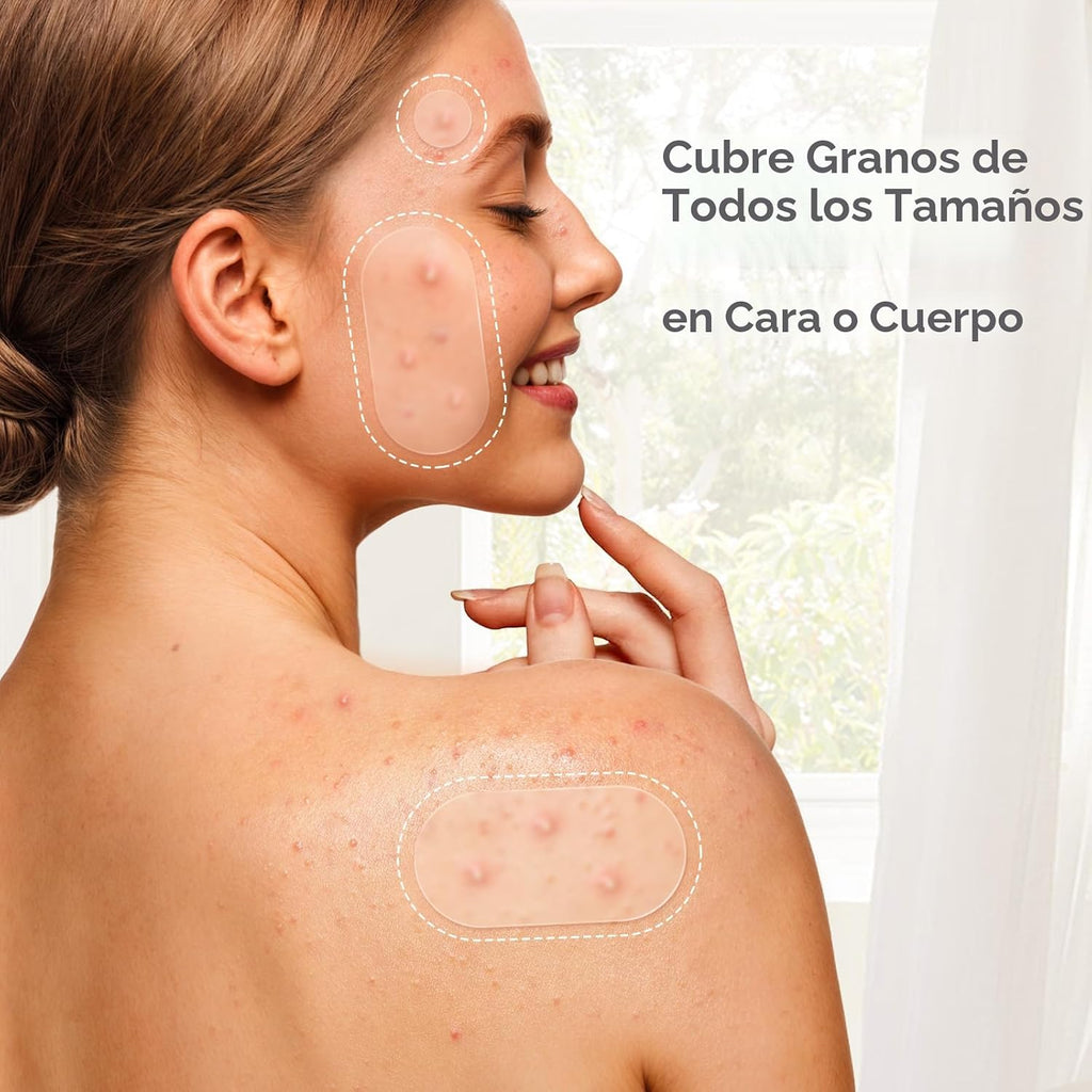 TKTK 443 parches de espinillas para cara, parche hidrocoloide para...