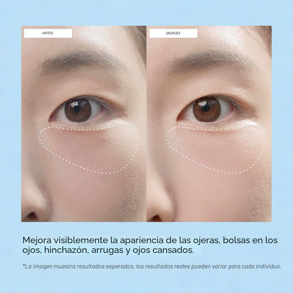 Terez &amp; Honor Parches para debajo de los ojos para ojeras, 60 m...