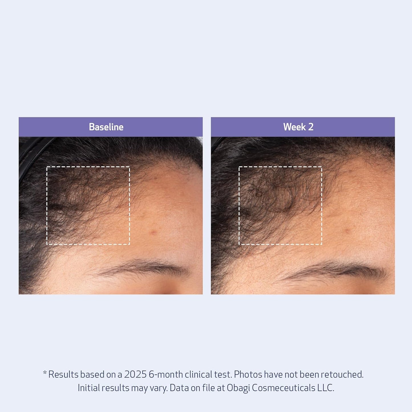 Obagi Nu-Cil BioStim - Suero para el cuero cabelludo con biotina, clínicamente probado para promover la salud del cuero cabelludo y ofrecer un cabello visiblemente más lleno y denso, ligero, fortalece