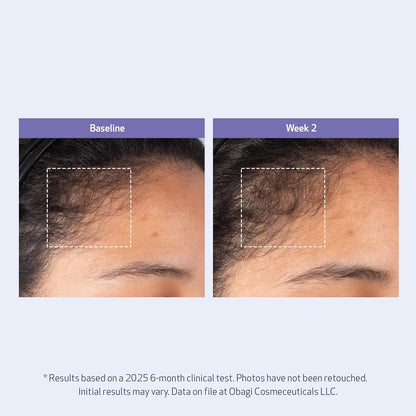Obagi Nu-Cil BioStim - Suero para el cuero cabelludo con biotina, clínicamente probado para promover la salud del cuero cabelludo y ofrecer un cabello visiblemente más lleno y denso, ligero, fortalece