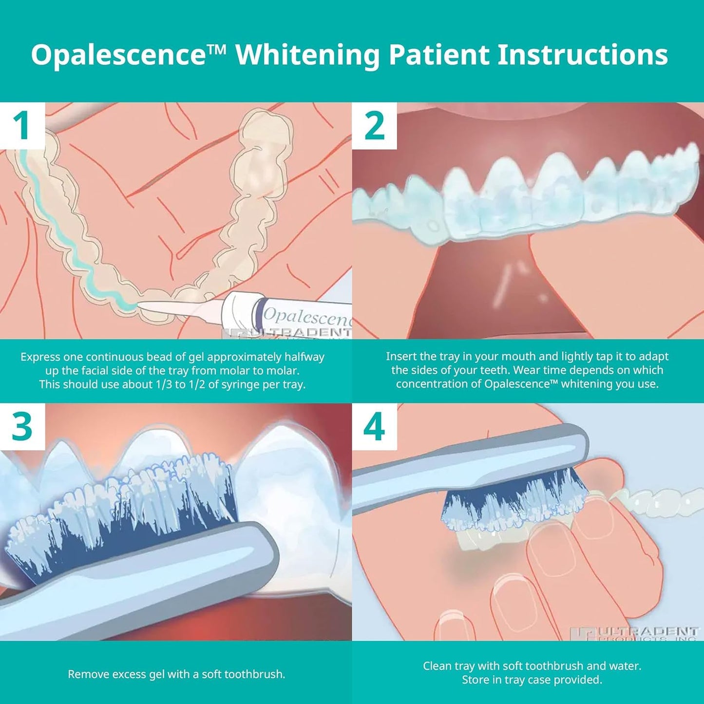 Opalescence 35% CP Mint - Jeringas de gel para blanquear los dientes - Kit de recarga (4 jeringas en total) Gel de peróxido de carbamida. Fabricado por Ultradent. Jeringas de repuesto para