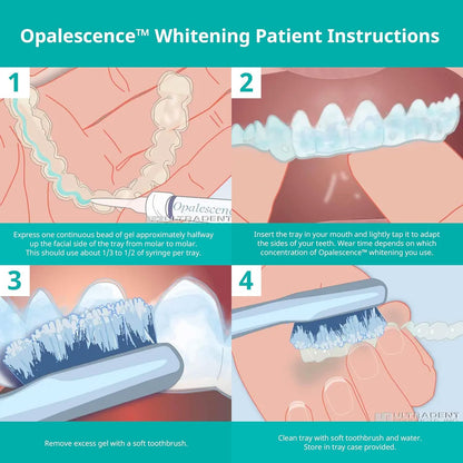 Opalescence 35% CP Mint - Jeringas de gel para blanquear los dientes - Kit de recarga (4 jeringas en total) Gel de peróxido de carbamida. Fabricado por Ultradent. Jeringas de repuesto para