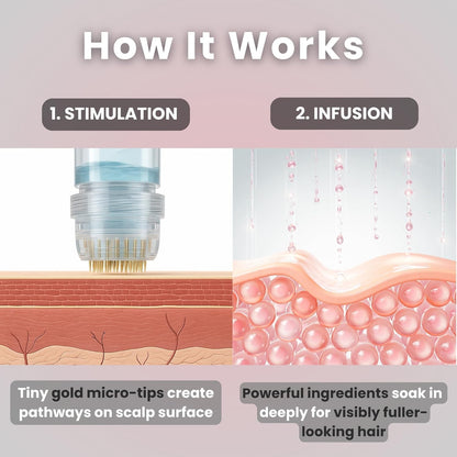 Kit de Renovación Capilar Micro Infusión de Glov Beauty – Estampación Dérmica de Oro de 0.25 mm con Ácido Hialurónico, Péptido y Suero Ampollas Botánico | Tratamiento Hidratante para el Cuero