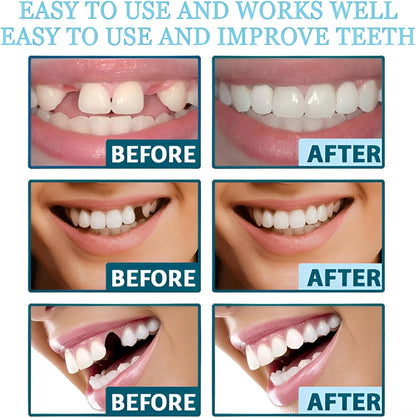 2 Pairs Temporary Smile Support Adjustable, Suitable for All Sexes,...