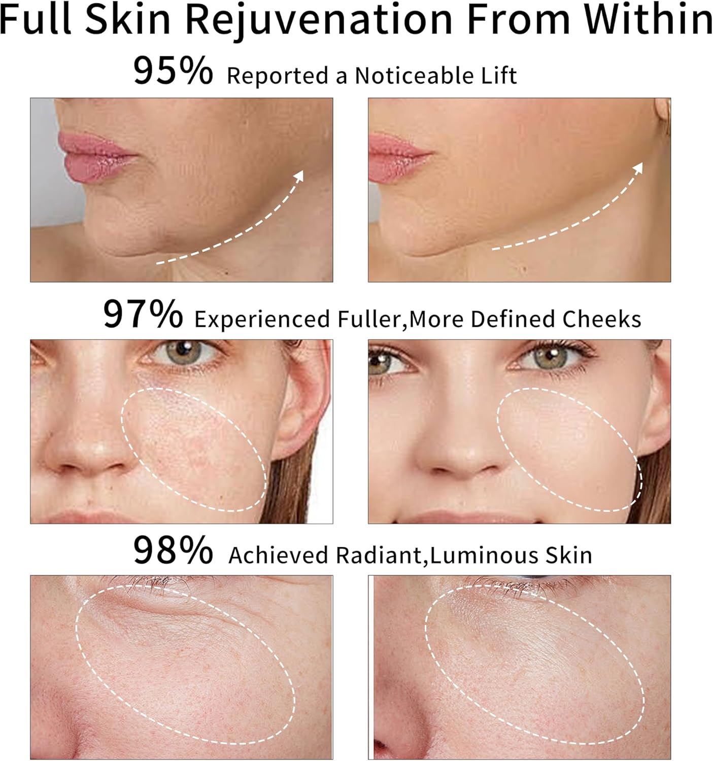 Era of Nature Dispositivo de tonificación facial de luz roja - Tecn...