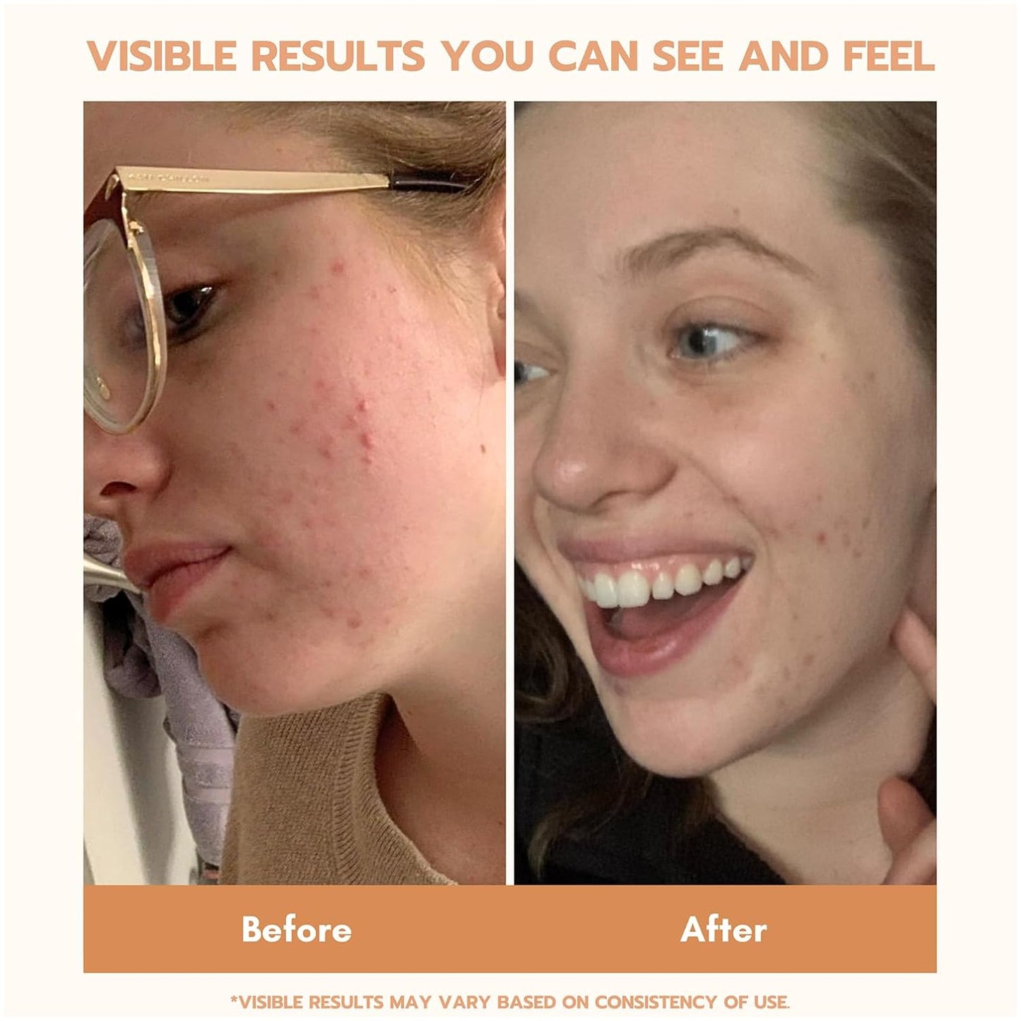 YEOUTH Set de cuidado de la piel: suero de retinol para cara, vitam...