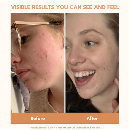 YEOUTH Set de cuidado de la piel: suero de retinol para cara, vitam...