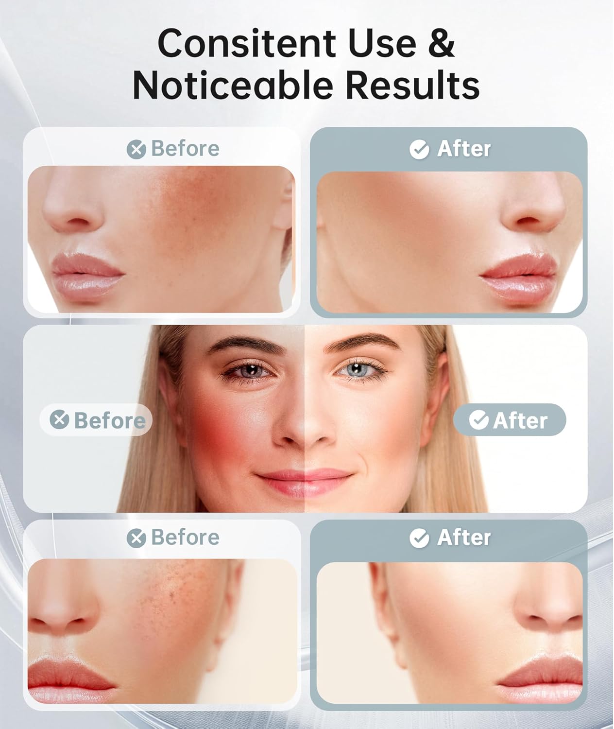 Dopsikn Masajeador facial de terapia de luz de 7 colores con vibrac...