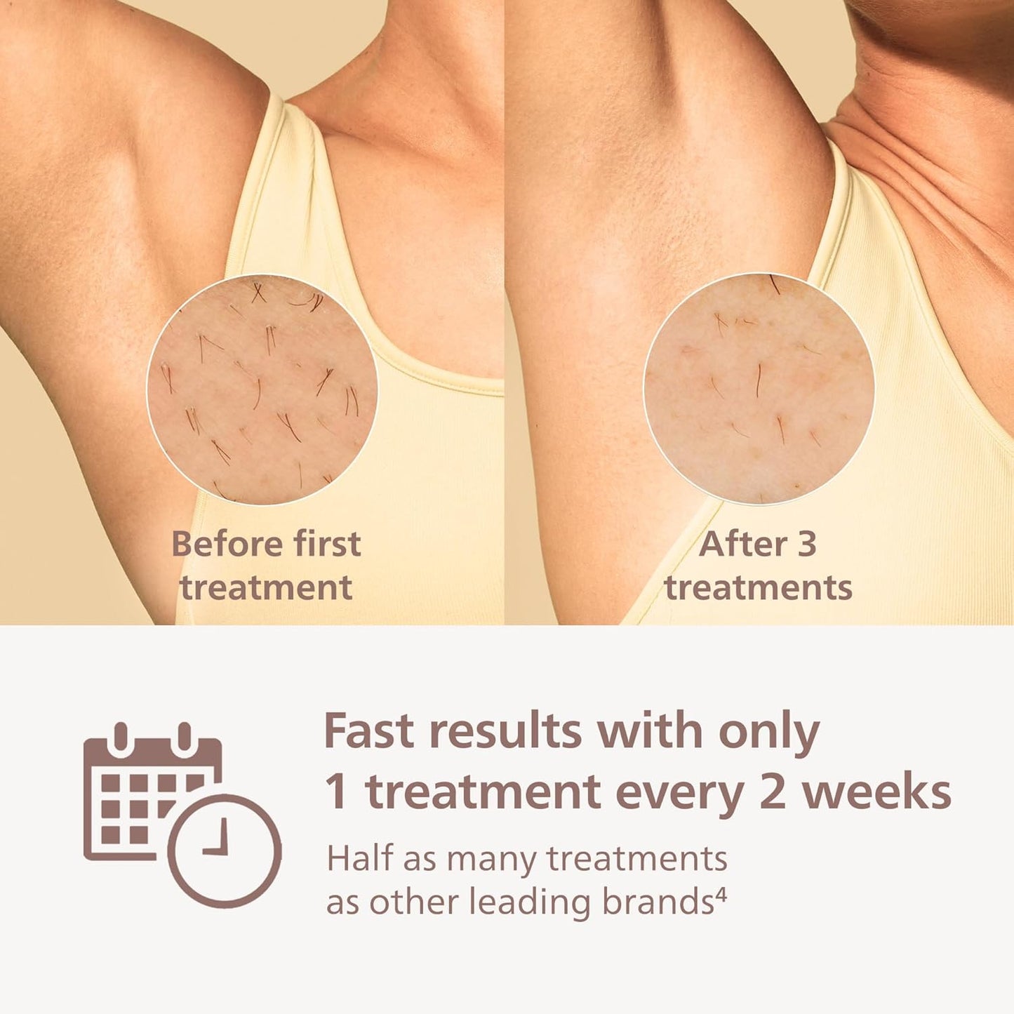 Philips Lumea 7000 Series Dispositivo de depilación IPL, para mujer...