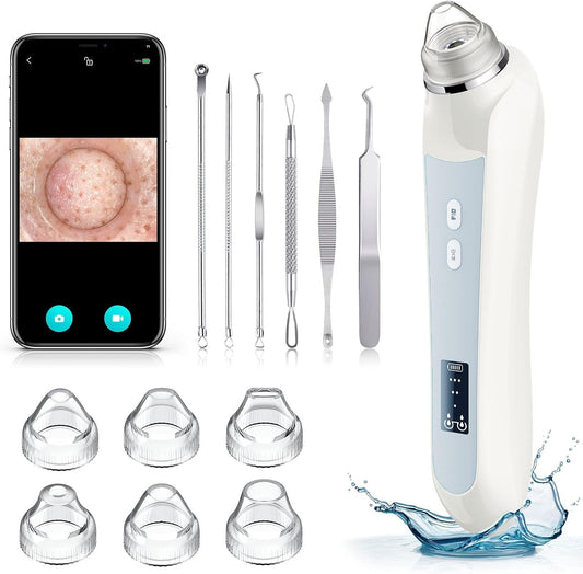 Aspiradora facial para eliminar puntos negros, removedor de puntos...