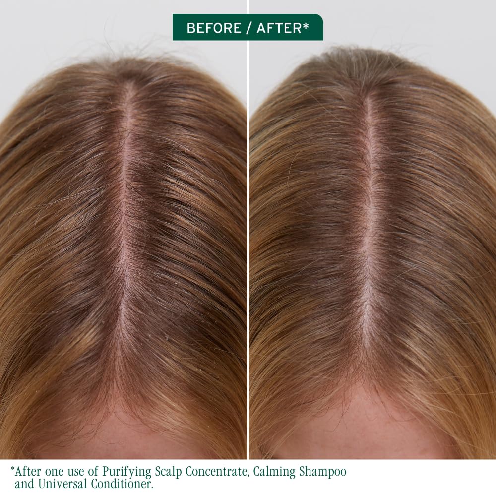 Biolage Scalp Sync - Concentrado purificador - Tratamiento exfoliante y aclarador del cuero cabelludo seco, refrescante y revitalizante, mezcla de té fermentado y ácido glicólico