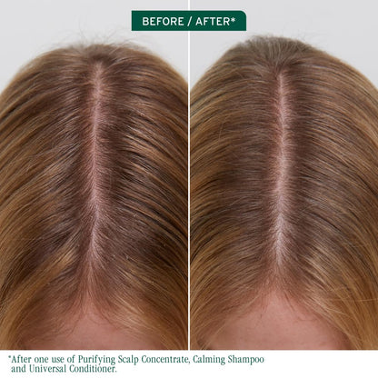 Biolage Scalp Sync - Concentrado purificador - Tratamiento exfoliante y aclarador del cuero cabelludo seco, refrescante y revitalizante, mezcla de té fermentado y ácido glicólico