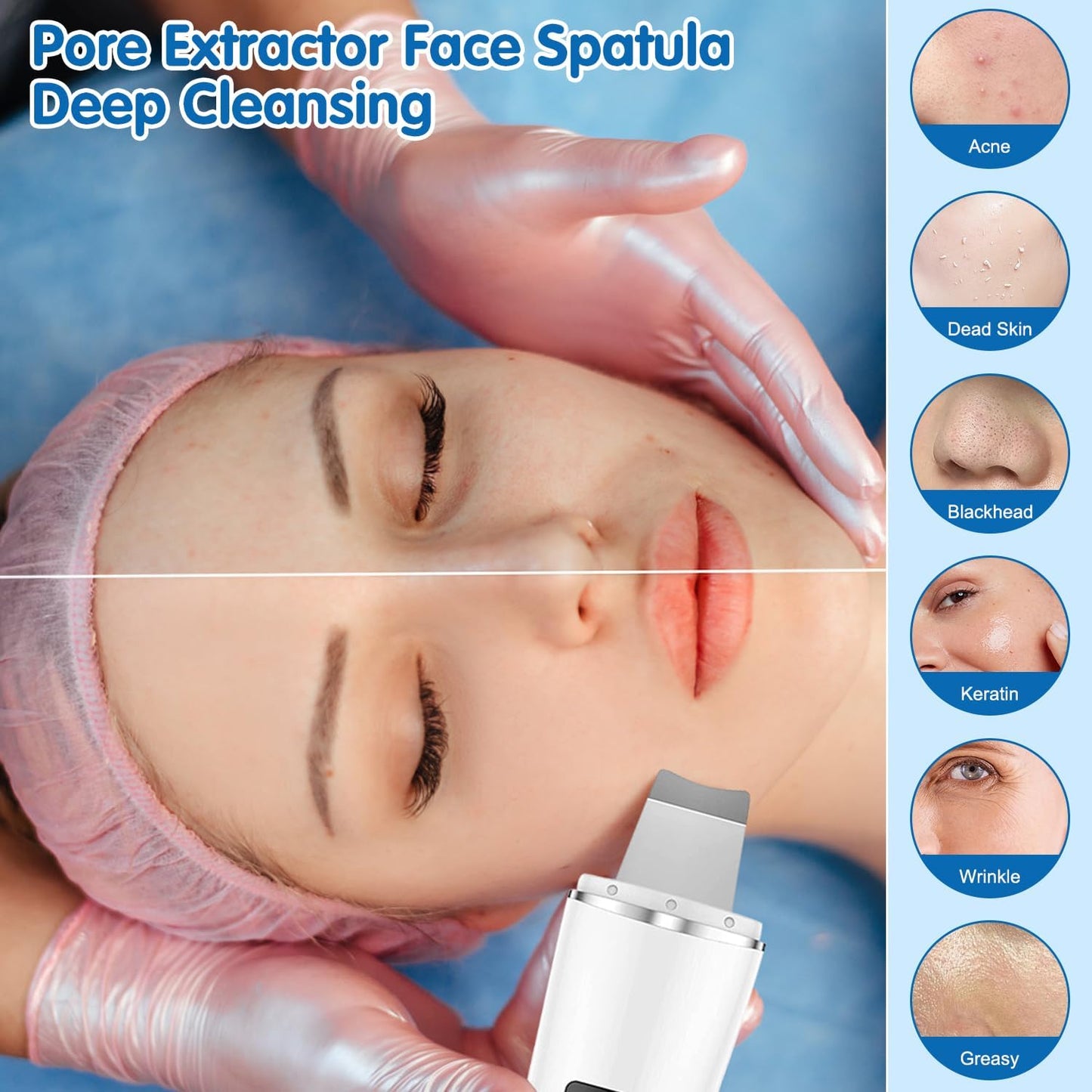 Espátula para la piel, limpiador de poros, extractor de poros, limp...