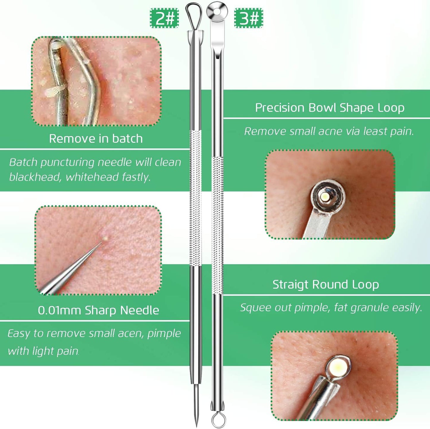 5 piezas de removedor de puntos negros, extractor de comedones, kit de pinzas curvas para puntos negros, kit de herramientas profesionales de acero inoxidable para eliminar espinillas, acné y manchas