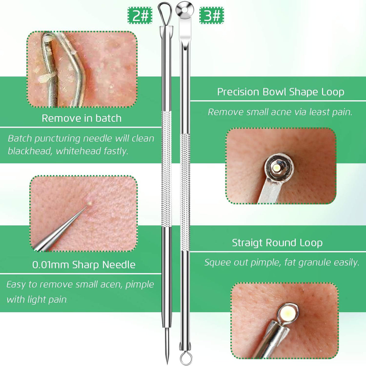 5 piezas de removedor de puntos negros, extractor de comedones, kit de pinzas curvas para puntos negros, kit de herramientas profesionales de acero inoxidable para eliminar espinillas, acné y manchas