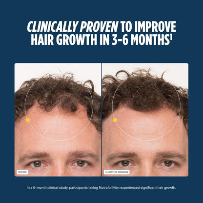 Nutrafol Suplementos para el Crecimiento del Cabello Masculino, Clínicamente Probados para Cabello Visiblemente Más Grueso y Cobertura del Cuero Cabelludo, Recomendado por Dermatólogos - Suministro