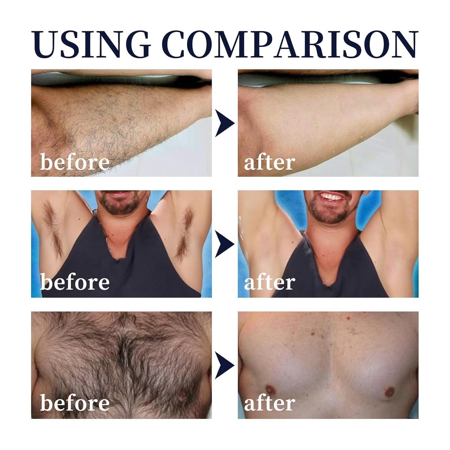 Espuma en aerosol para depilación para hombre, para cuerpo, crema d...