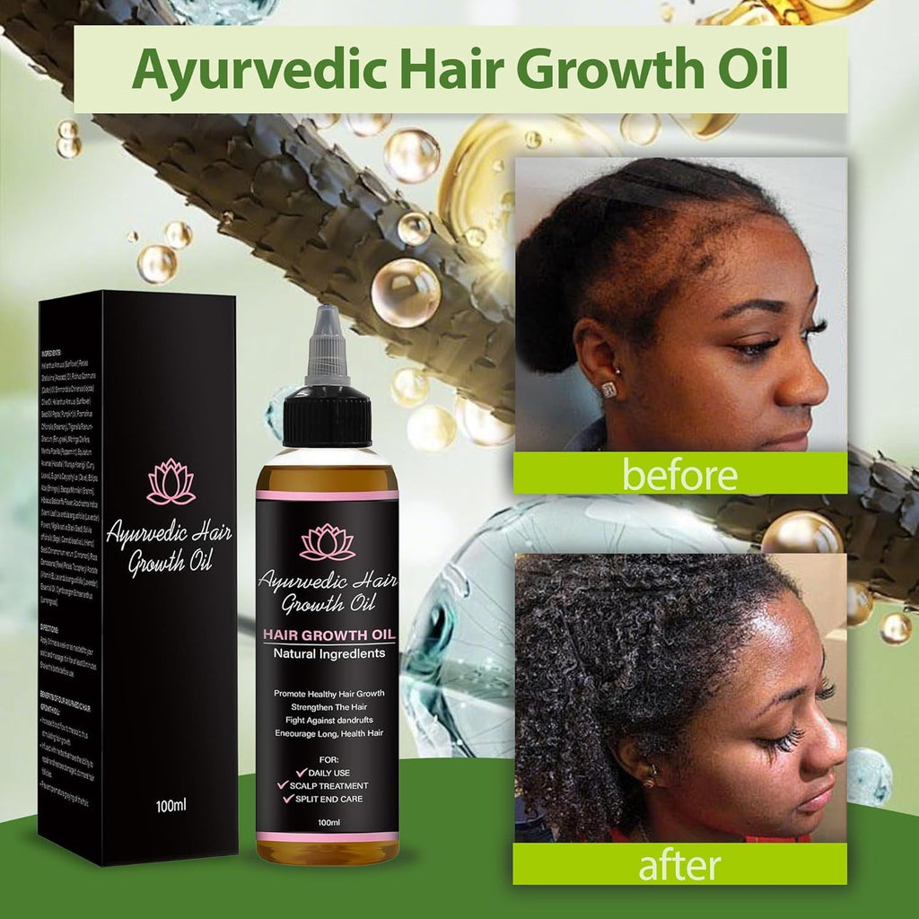 LIFEWITQUEENP Aceite de crecimiento para el cuidado del cabello, ac...