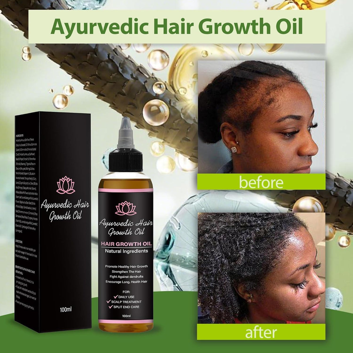 LIFEWITQUEENP Aceite de crecimiento para el cuidado del cabello, ac...