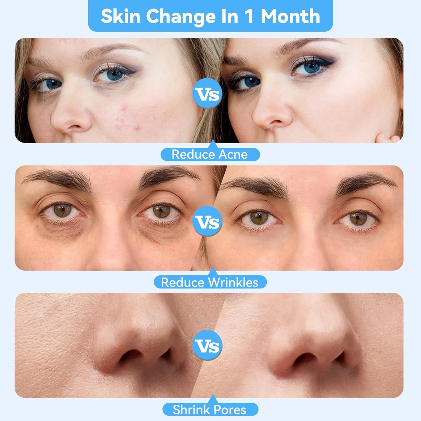 Máquina facial mejorada de micro dermoabrasión de diamante, herrami...