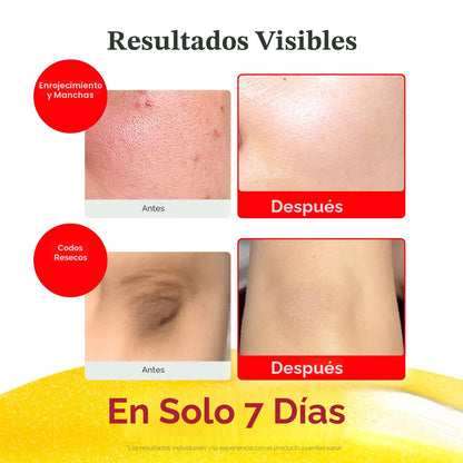 EQQUALBERRY Suero iluminador de vitaminas | Niacinamida 4% + suero...