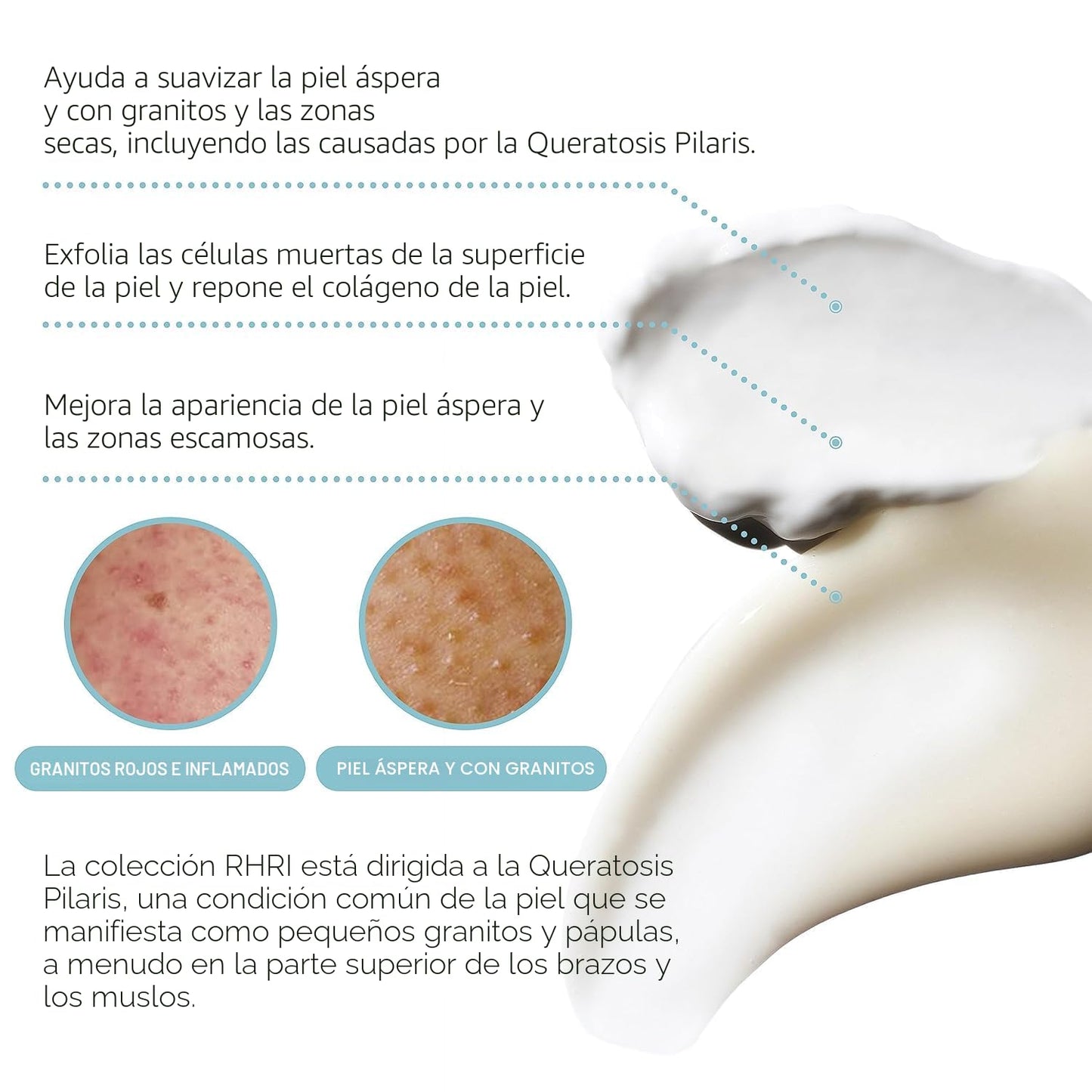 KP Bump Eraser Body Set con 10% AHA | Tratamiento de queratosis pil...