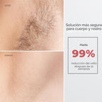 Depilación láser IPL para mujeres y hombres, depilación láser de us...