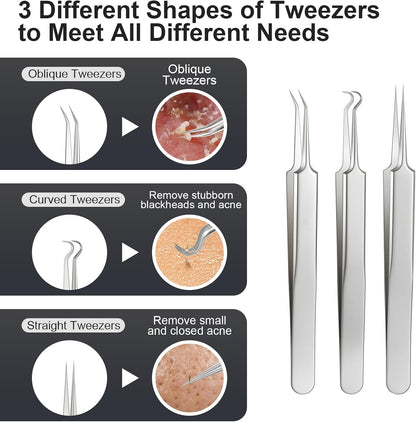 Meidaier Kit de herramientas de eliminación de puntos negros de ale...