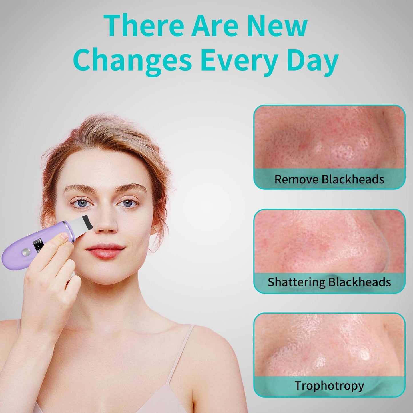 Espátula facial para depurar la piel - Removedor de puntos negros h...