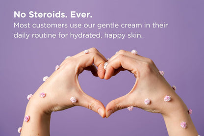 Crema facial para dermatitis seborreica para pieles sensibles, hidrata y apoya la barrera cutánea con aceite MCT, escualano, crema hidratante para rostro, cuero cabelludo y cuerpo, sin esteroides