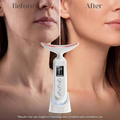 Masajeador facial con luz LED: dispositivo facial de 9 colores - Va...
