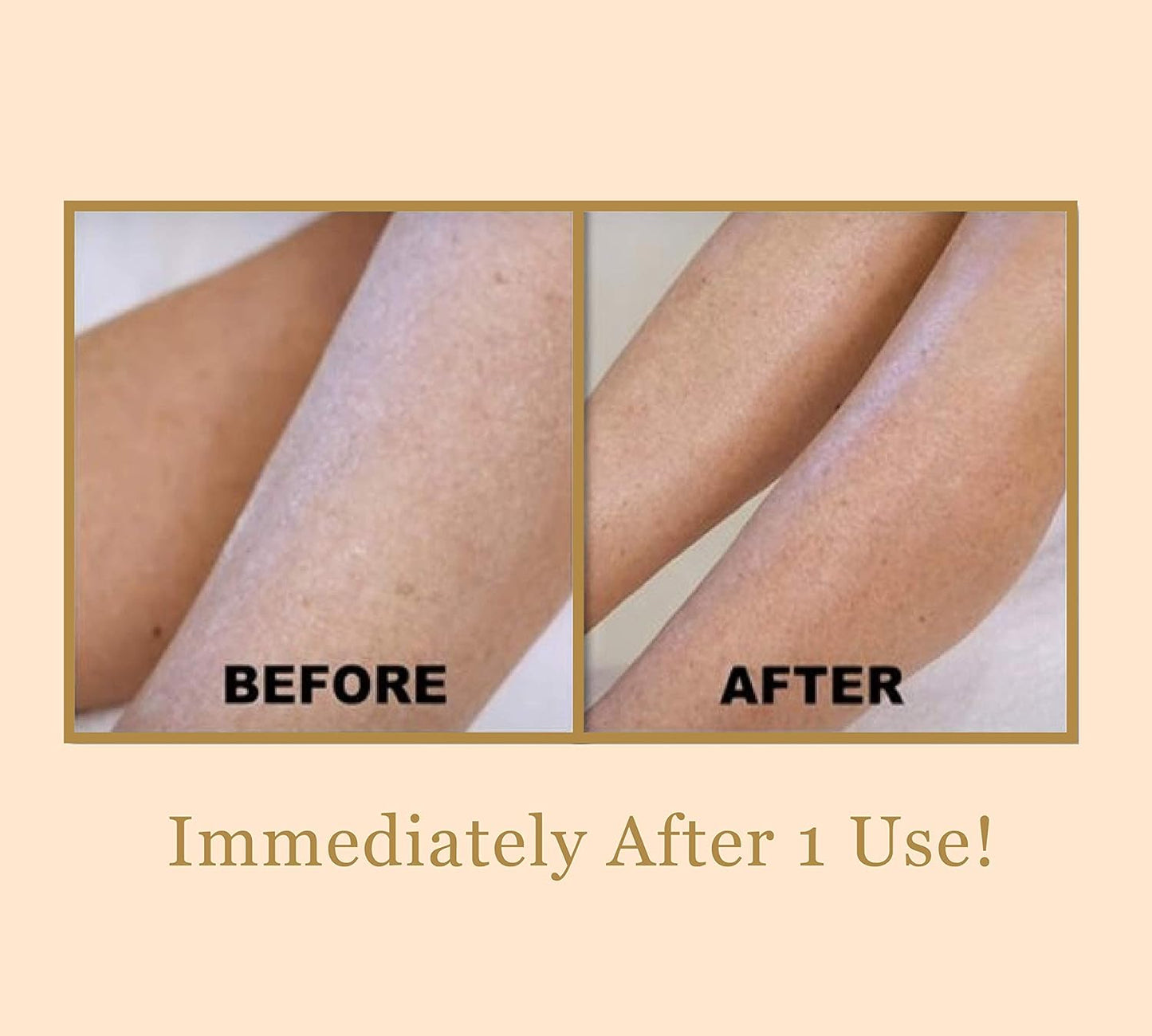 Bee Stunning DIAMONDBUFF Microderm - Herramienta de exfoliación \u2...