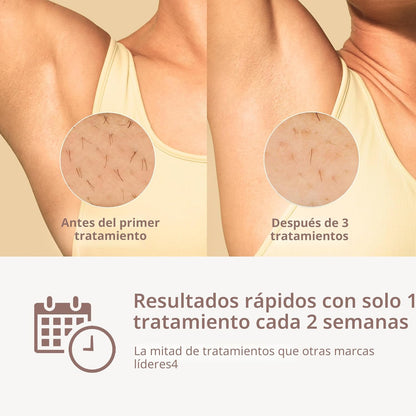 Philips Lumea Serie 8000 Dispositivo de Depilación IPL, Reducción P...