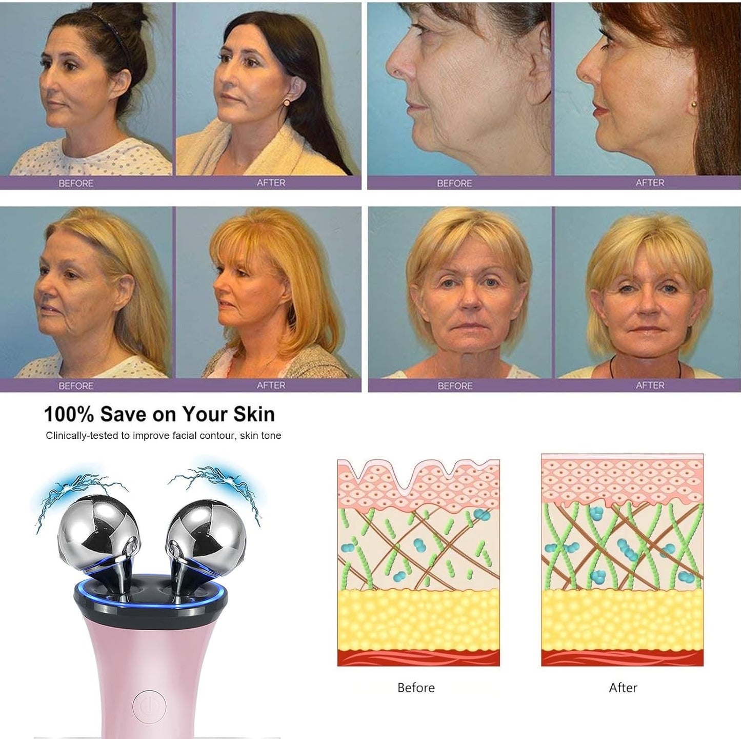 Dispositivo facial de microcorriente, masajeador facial eléctrico,...