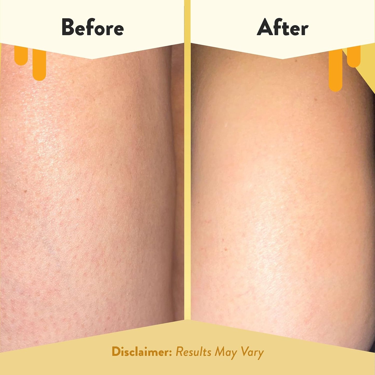 ECZEMA HONEY Gel de baño calmante - Gel de ducha diario y tratamiento de eccema - Gel de ducha para piel sensible para adultos, niños y bebés - Limpiador corporal para aliviar el eccema (13 onzas)