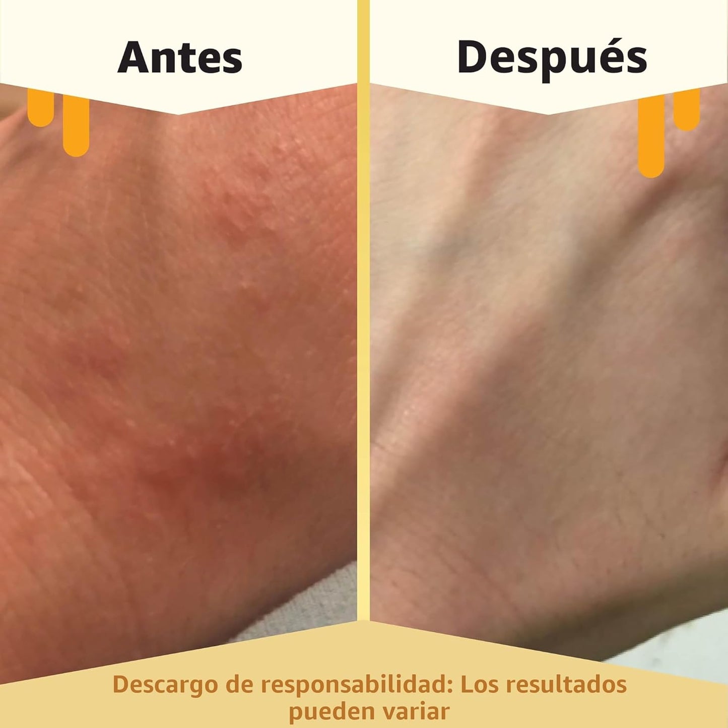 ECZEMA HONEY Loción corporal de avena - Crema de manos y cuerpo par...