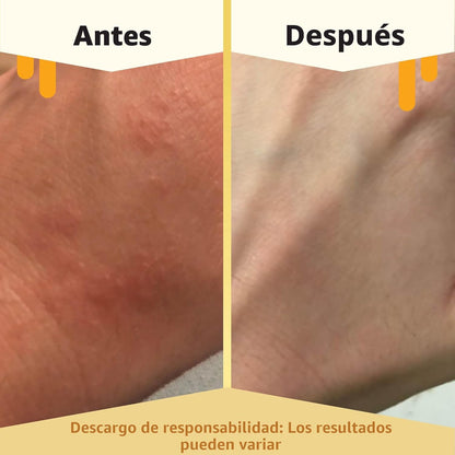 ECZEMA HONEY Loción corporal de avena - Crema de manos y cuerpo par...